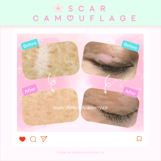 ☘️ Scar Camouflage - PMU, Numbing Cream & Beauty Products to Canada | USA | Australia | Austria | Denmark | UK | France | Germany | Ireland | Italy | Netherlands | New Zealand... # #